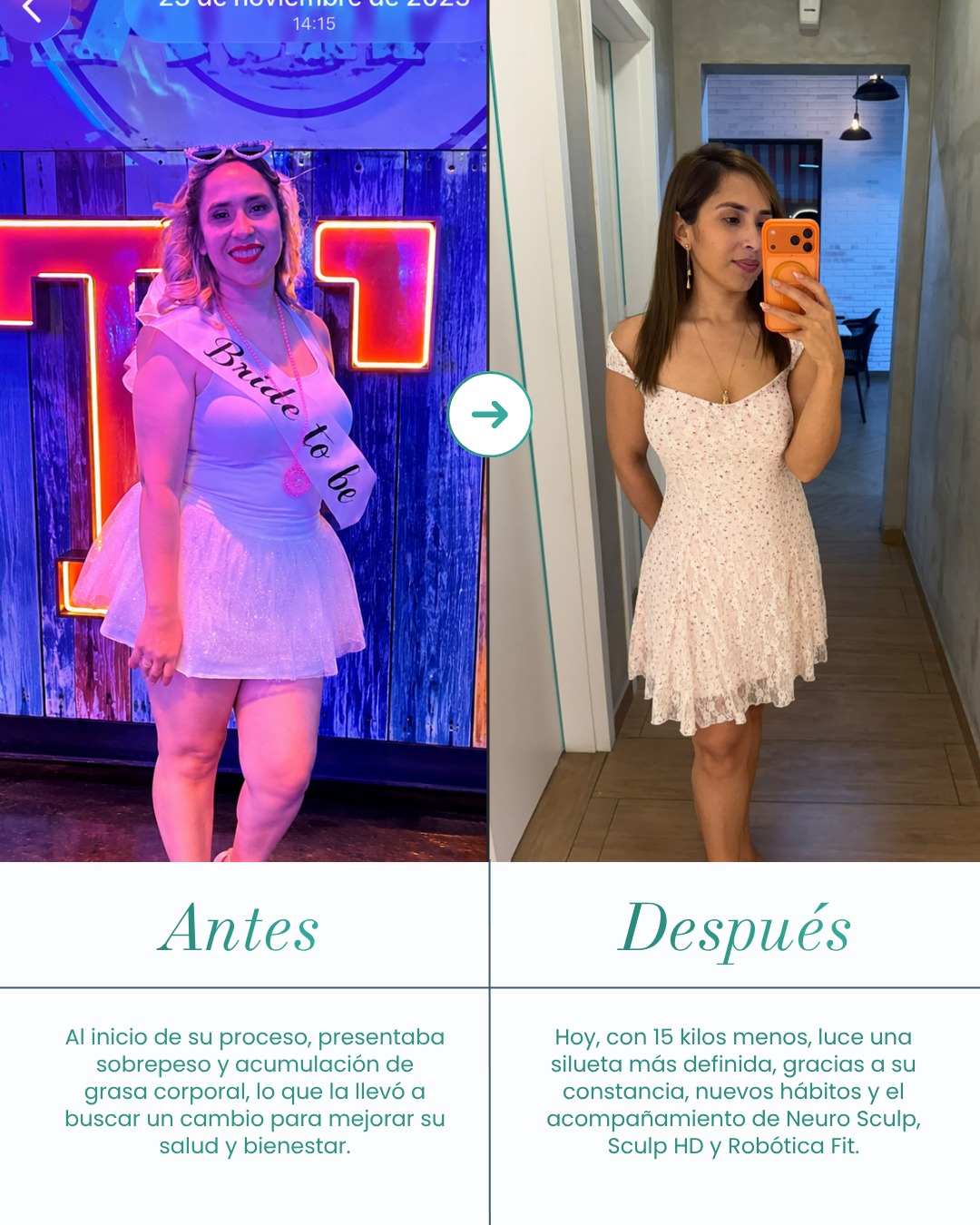 Caso Antes e Depois - 15kg a menos